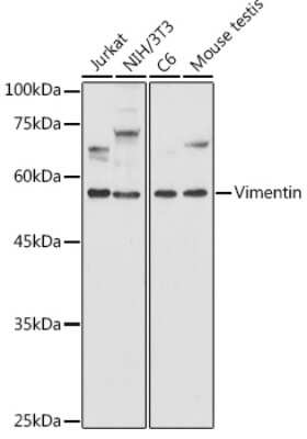 Western Blot: Vimentin AntibodyAzide and BSA Free [NBP3-03221]